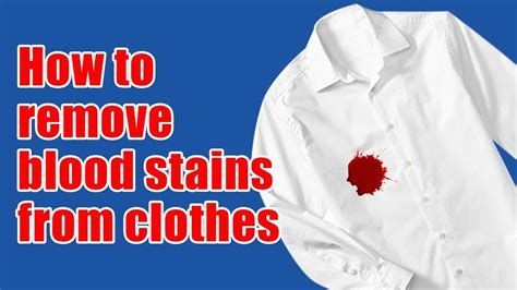 clean blood stains off clothing